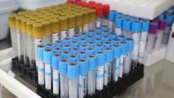 Вакцину для иммунизации от гриппа доставили на Ставрополье