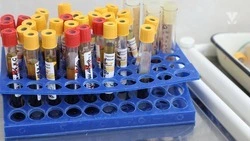 На Ставрополье показатель заболеваемости ВИЧ-инфекцией за год снизился на 4,6%